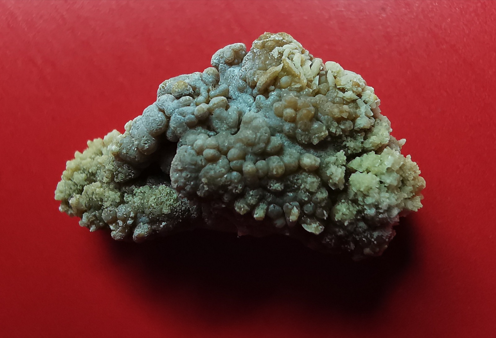 A real kidney stone with a rough crystalline surface