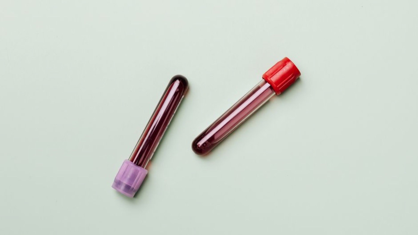 Blood samples in a laboratory